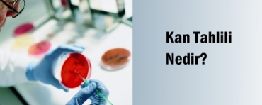 Kan tahlili nedir? Nasl yaplr?