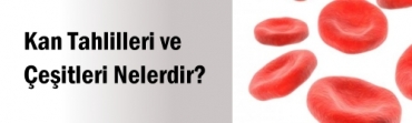 Kan Tahlilleri ve eitleri Nelerdir?