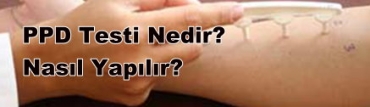 PPD Testi Nedir?