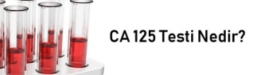 CA 125 Testi Nedir?