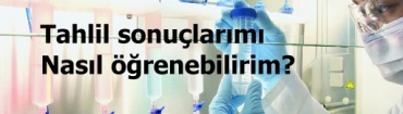 Tahlil sonularm nasl renebilirim?