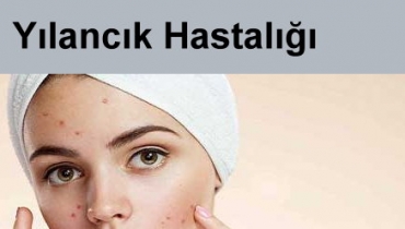 Ylanck Hastal