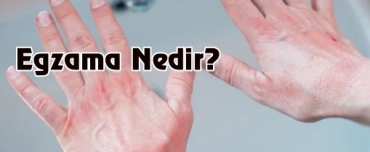 Egzama Nedir?