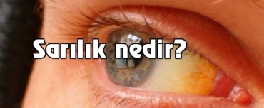Sarlk nedir?
