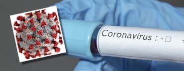 Koronavirüs (COVID-19) test sonuçları öğrenme?